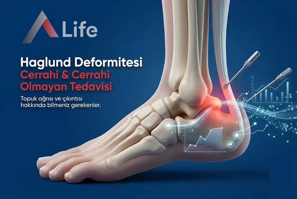 Haglund Deformitesi: Tanım ve Nedenleri 